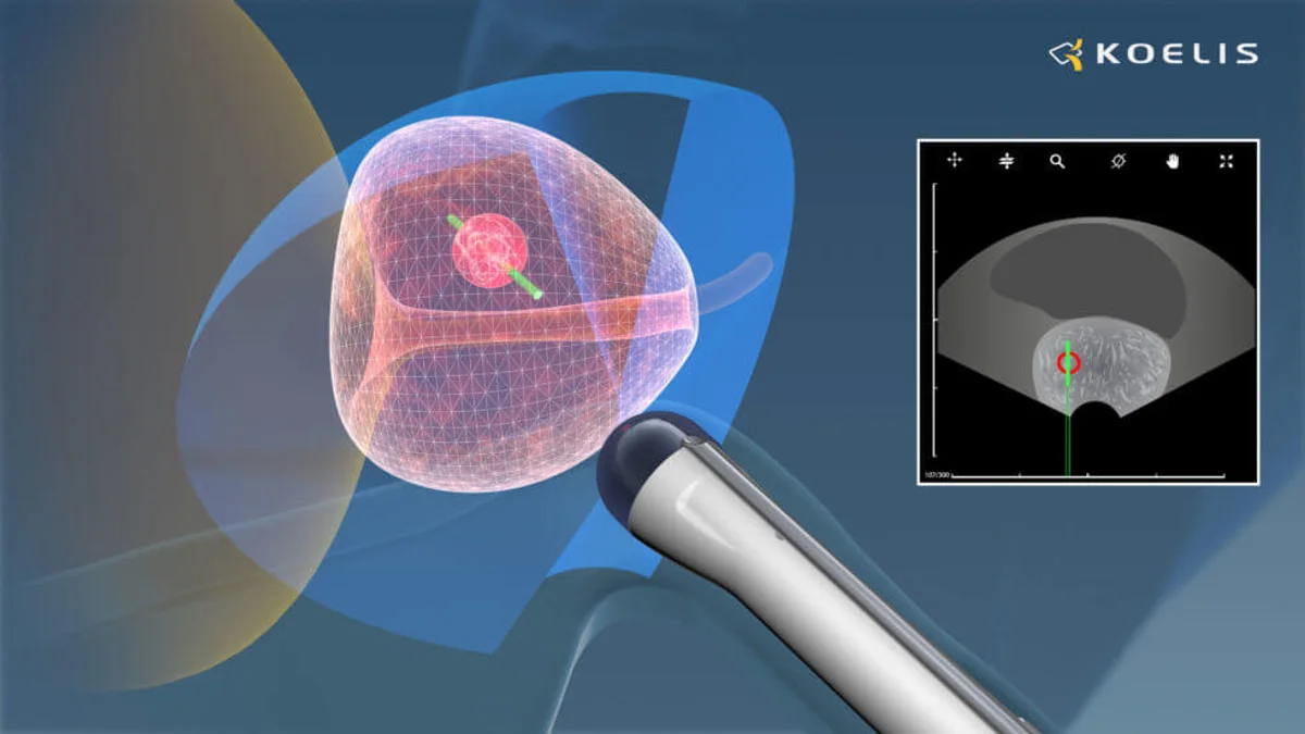 Biopsia prostática por fusión